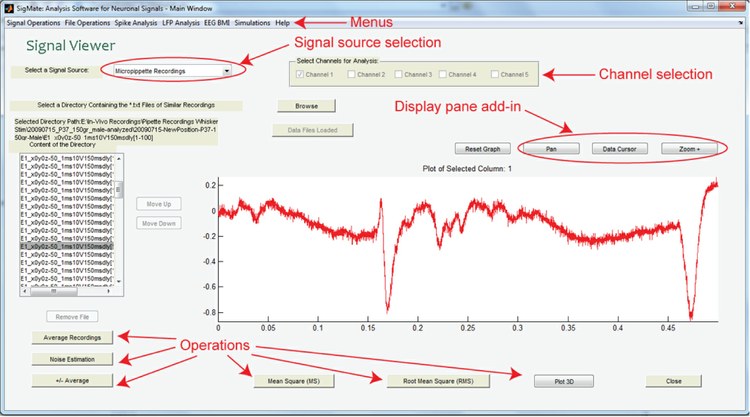 A MATLAB Based Toolbox for Processing and Analysis of Multichannel, Multisource Cortical Local Field Potentials