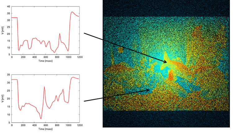 A realistic large-scale model of the retinal cone mosaic