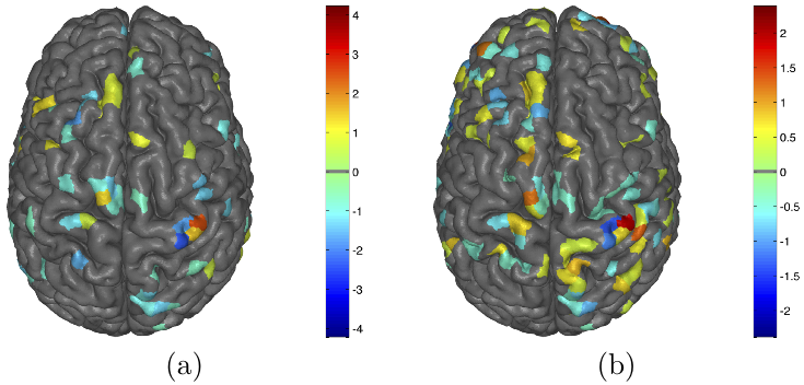 EEG Source Estimation via Cortical Graph Smoothing