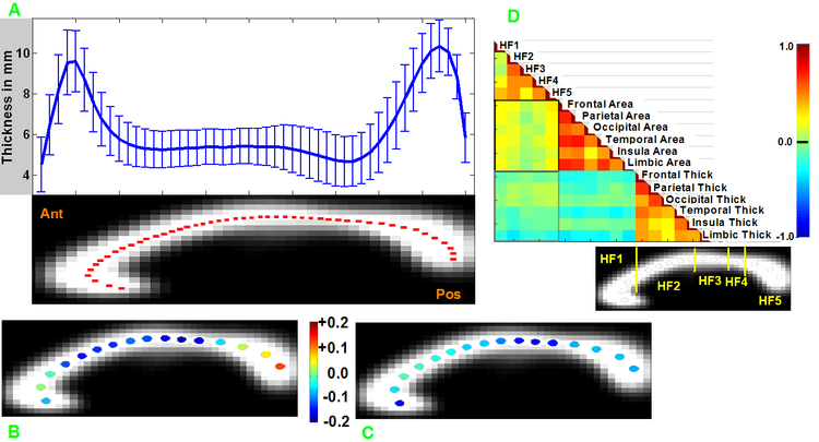 Fast, fully automated MRI-based measurement of the human corpus callosum