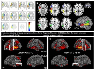 Hemispheric asymmetries in the resting-sate functional connectivity patterns of the brain regions critical for language comprehension