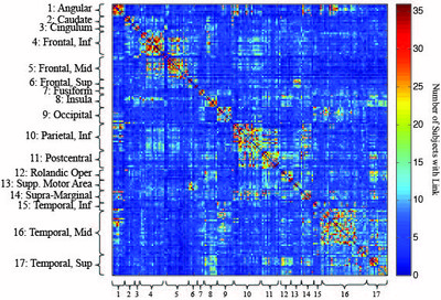 Identification and Classification of Functional Modules in the Brain