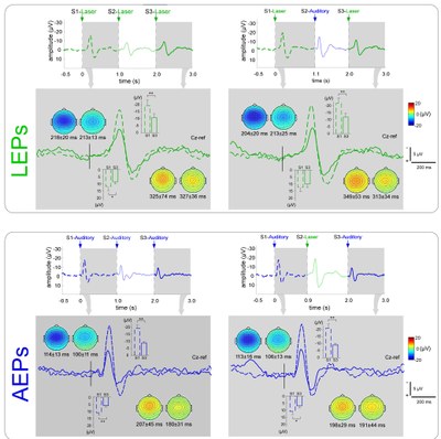 New evidence to explain 'response decrement' in sensory ERPs