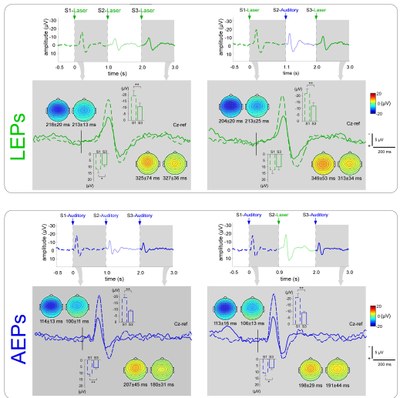 New evidence to explain 'response decrement' in sensory ERPs