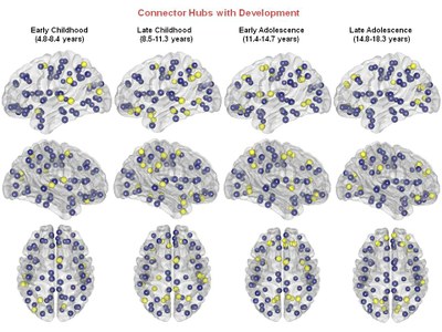 Segregation and Integration of Cortical Connections in the Developing Brain Segregation and Integration of Cortical Connections in the Developing Brain
