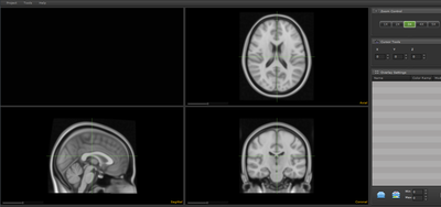 The Computable Brain: an interactive website to allow exploration and sharing of functional imaging data