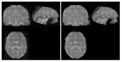 Using neuRosim to simulate magnitude fMRI data containing physiological noise 