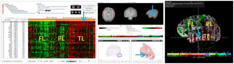 Visualization and exploration of the transcriptomic landscape of the human brain